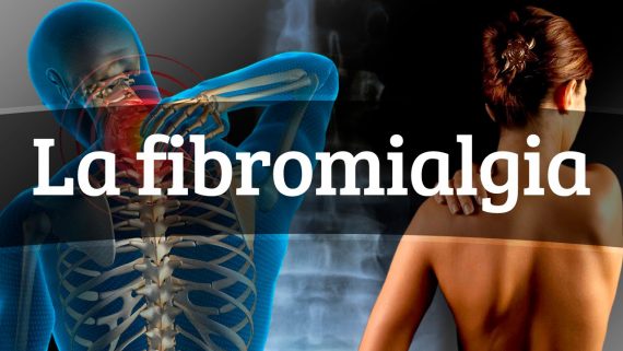 fibromialgia