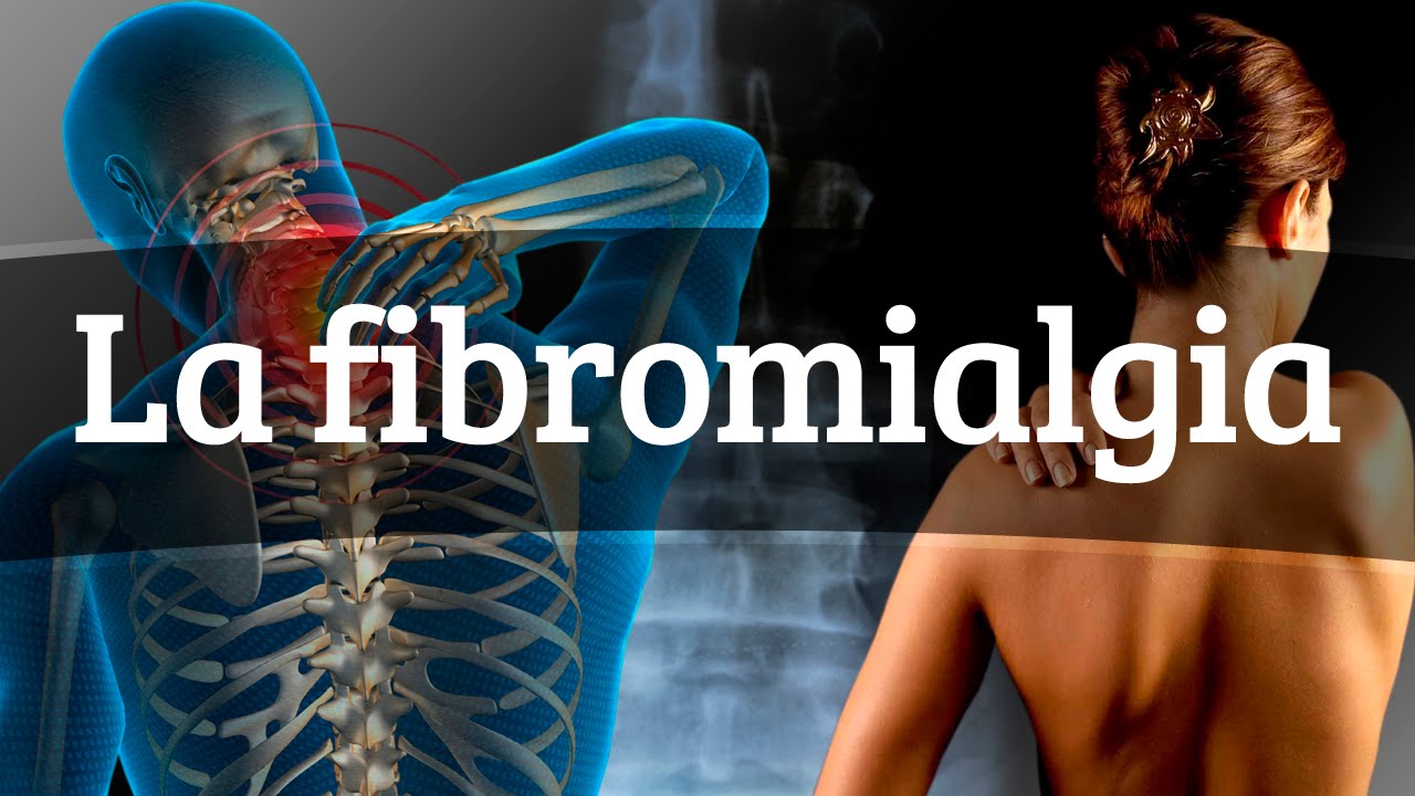 fibromialgia